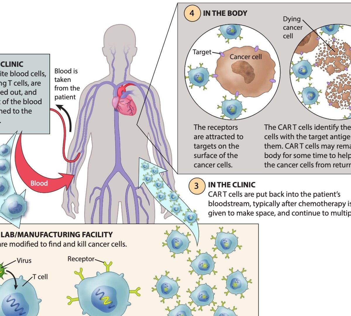 Clinical Pharmacology Considerations and Modeling of CAR-T Cell Therapies Using Monolix®