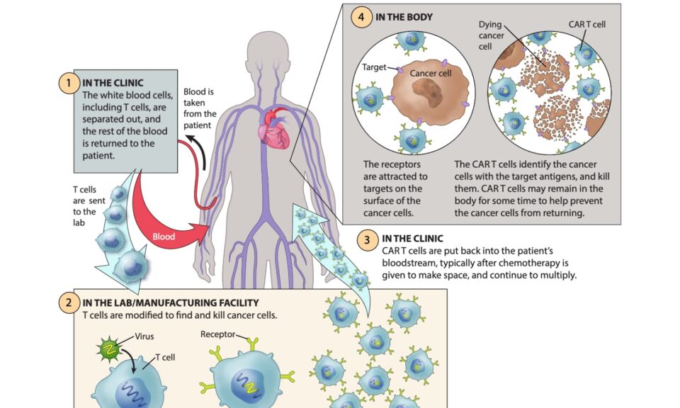 Clinical Pharmacology Considerations and Modeling of CAR-T Cell Therapies Using Monolix®